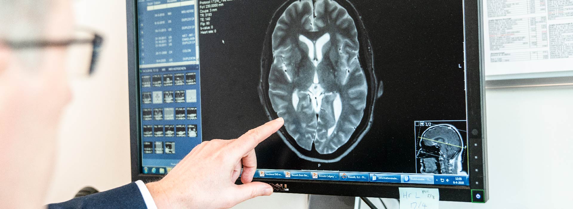 Hersenonderzoeker toont MRI foto van hersenen.